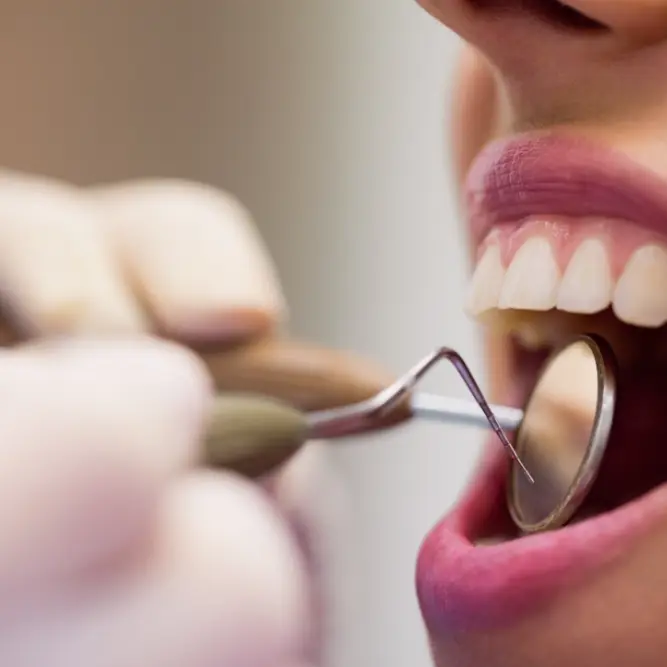 Dettaglio ravvicinato di una visita odontoiatrica: uno specchietto e uno strumento vengono utilizzati per l&rsquo;esame dei denti di una paziente sorridente.